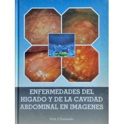 Enfermedades del hígado y...